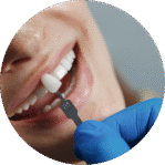 Implante Dentário 55 Facetas dentárias em Sorocaba para transformar o sorriso com estética natural e harmonia facial.