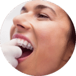 Implante Dentário 56 Alinhadores invisíveis em Sorocaba para corrigir os dentes com conforto, estética e tecnologia 3D.