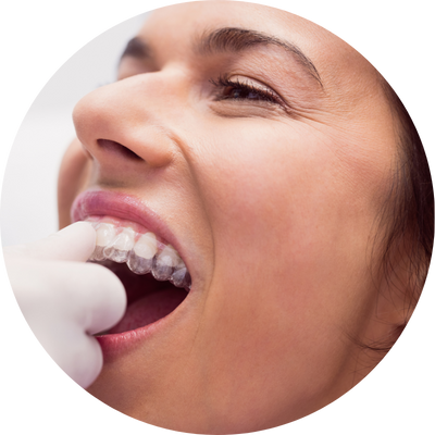 Alinhadores invisíveis em Sorocaba para corrigir os dentes com conforto, estética e tecnologia 3D.