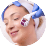 Fundo de mármore branco com destaque para microagulhamento com infusão de ácidos na clínica Harmodont em Sorocaba.