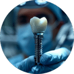 Implante Dentário 54 Implante dentário em Sorocaba com opção de implante unitário ou prótese fixa tipo protocolo para repor todos os dentes.